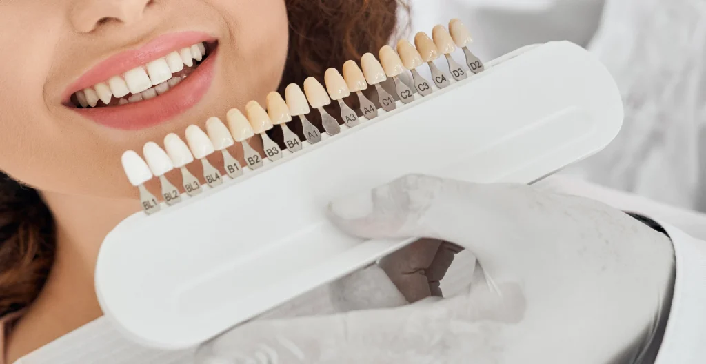 VENEERS