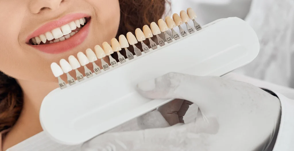 VENEERS