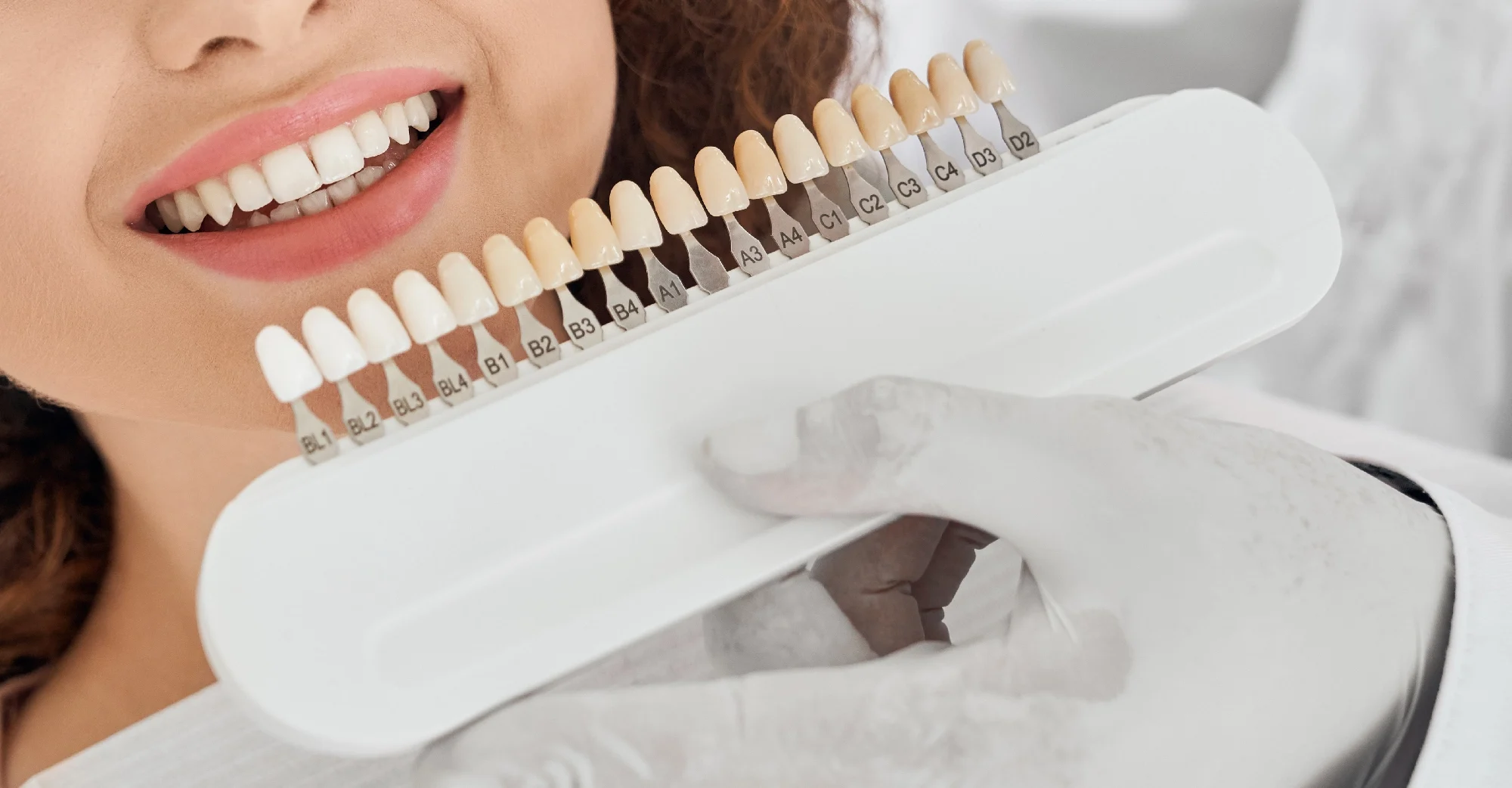 VENEERS