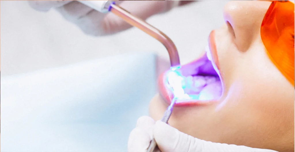 WHITENING