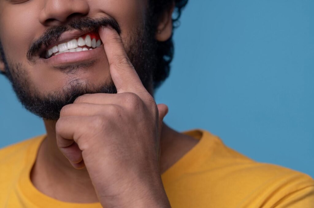 adult-man-showing-his-periodontal-disease-before-camera_259150-57666 Gum Disease Treatment