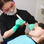 dental sealants